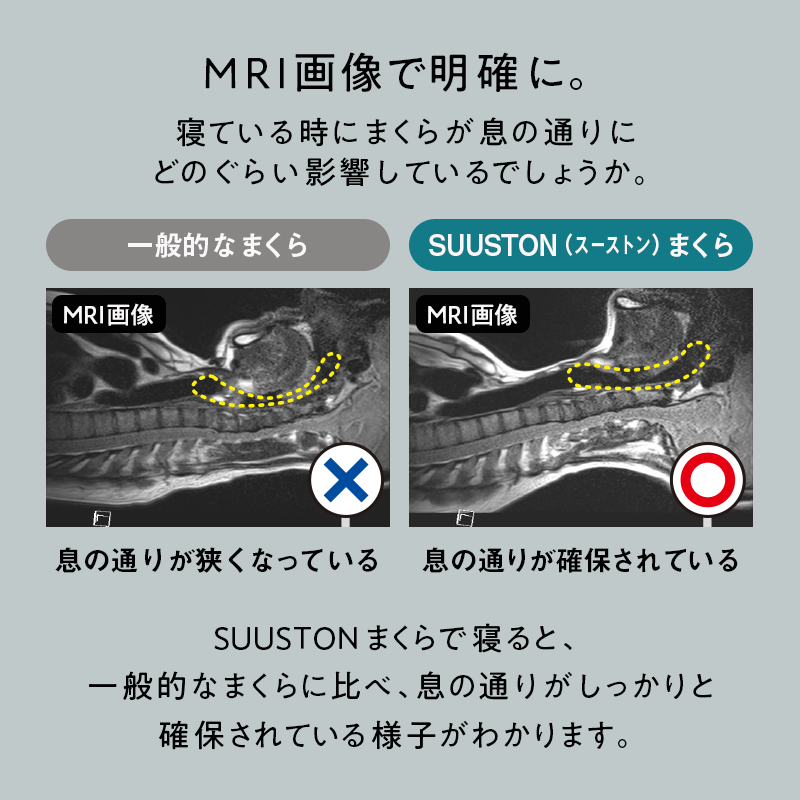 【SUUSTON】スーストン|深い呼吸で深く眠れる枕|睡眠中の空気の通り道を確保|14日間返金保証付