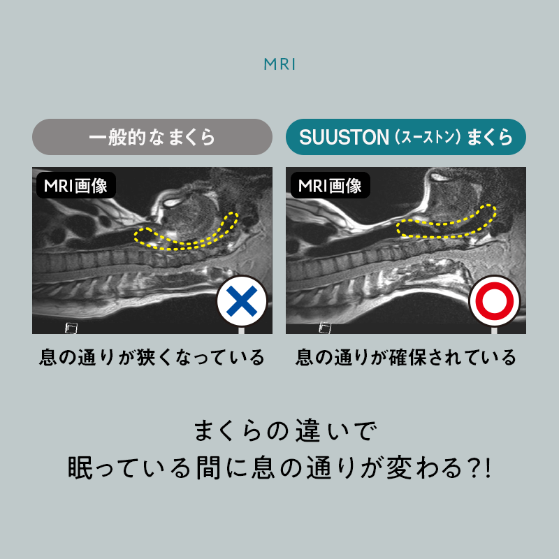 【SUUSTON】スーストン｜深い呼吸で深く眠れる枕｜睡眠中の空気の通り道を確保｜14日間返金保証付